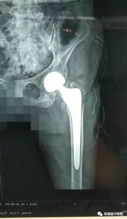 1563786468176638.png 2019-07-22_170614.png